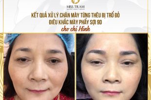Before And After Treatment of Red Embroidery Eyebrows - 9D Threading Sculpture 23