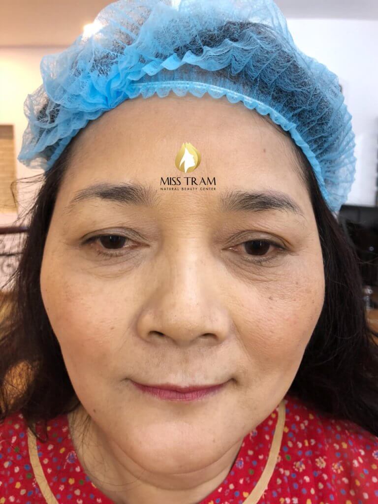 Before And After Treatment of Red Embroidery Eyebrows - 9D Threading Sculpture 7