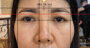 Before And After Beauty Pictures With Natural Eyebrow Sculpting Technology 22