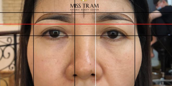 Before And After Beauty Pictures With Natural Eyebrow Sculpting Technology 4