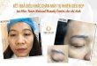Before And After Natural Eyebrow Sculpting Results For Female Clients 33