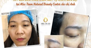 Before And After Natural Eyebrow Sculpting Results For Female Clients 32