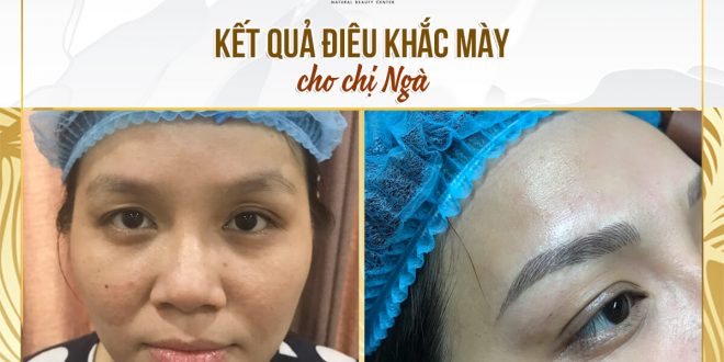 Trước Và Sau Kết Quả Thực Hiện Điêu Khắc Mày Phẩy Sợi Tự Nhiên 4