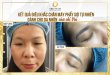 Before And After Eyebrow Sculpting For Customers With Oily Skin 1