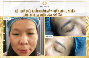 Trước Và Sau Khi Điêu Khắc Mày Dành Cho Chị Khách Có Làn Da Nhờn 18