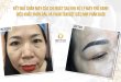 Before And After The Process of Browing Eyebrows, Head Sculpting And Powder Spraying 22