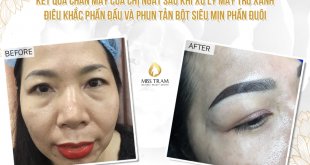 Trước Và Sau Quá Trình Xử Lý Mày Trổ Xanh, Điêu Khắc Đầu Và Phun Tản Bột Phần Đuôi Mày 5