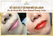 Before And After Treatment And Beauty By Collagen Lip Spray 15