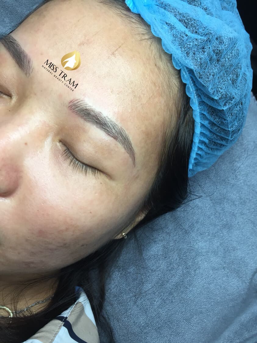 Before And After Eyebrow Sculpting For Customers With Oily Skin 5