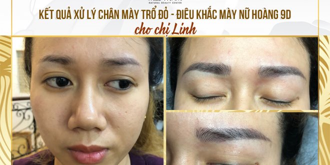 Before And After Treating Old Eyebrows - Queen's Eyebrow Sculpture 3