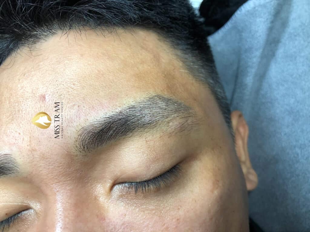 Before And After Male Eyebrow Sculpture Increase Strength, Masculine 8