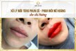 Before And After Treatment Of Old Lip Spray - New Queen Lip Sculpture For Women 58