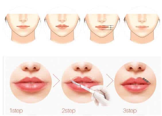 How to shape the lip line before spraying