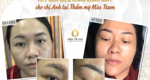 Before And After The Results Of Beautiful Eyebrow Sculpting For Women 1