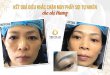 Before And After The Results Of Natural Fiber Brow Sculpting 17