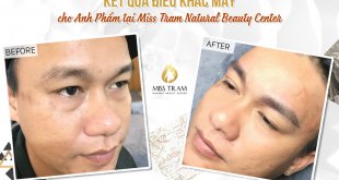 Before And After The Results Of Natural Fiber Brow Sculpting For Customers 39