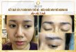 Before And After The Results Of Treatment Of Red Eyebrows And Queen Eyebrow Sculpture 9D 22