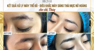 Before And After The Results Of Treatment Of Red And Red Eyebrows And Sculpting Thai Shaped Brows 10