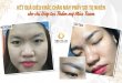 Before And After Making Beauty Brow Sculpting Technology 59