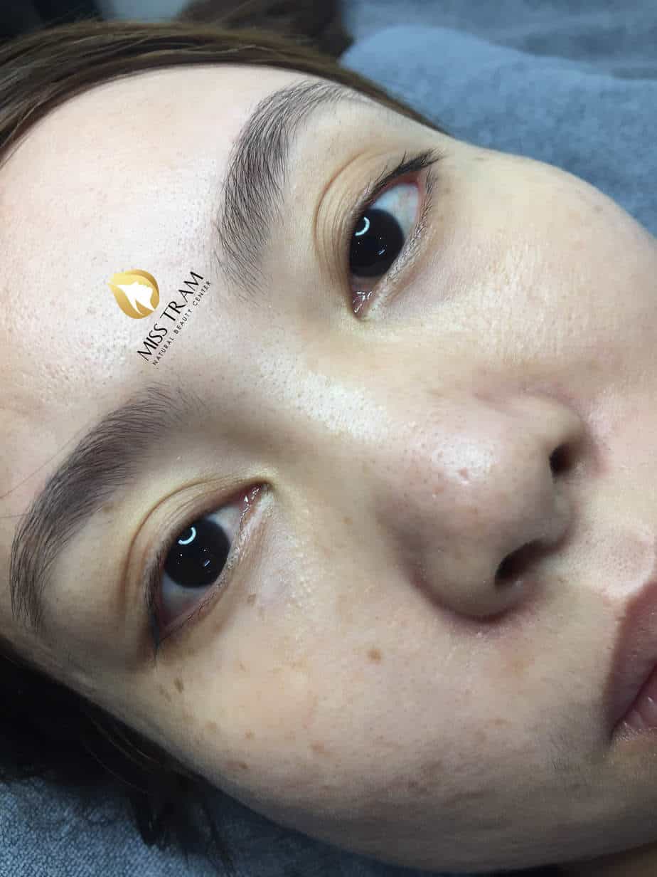Before And After The Results Of Natural Eyelid Spraying For Female Customers 7