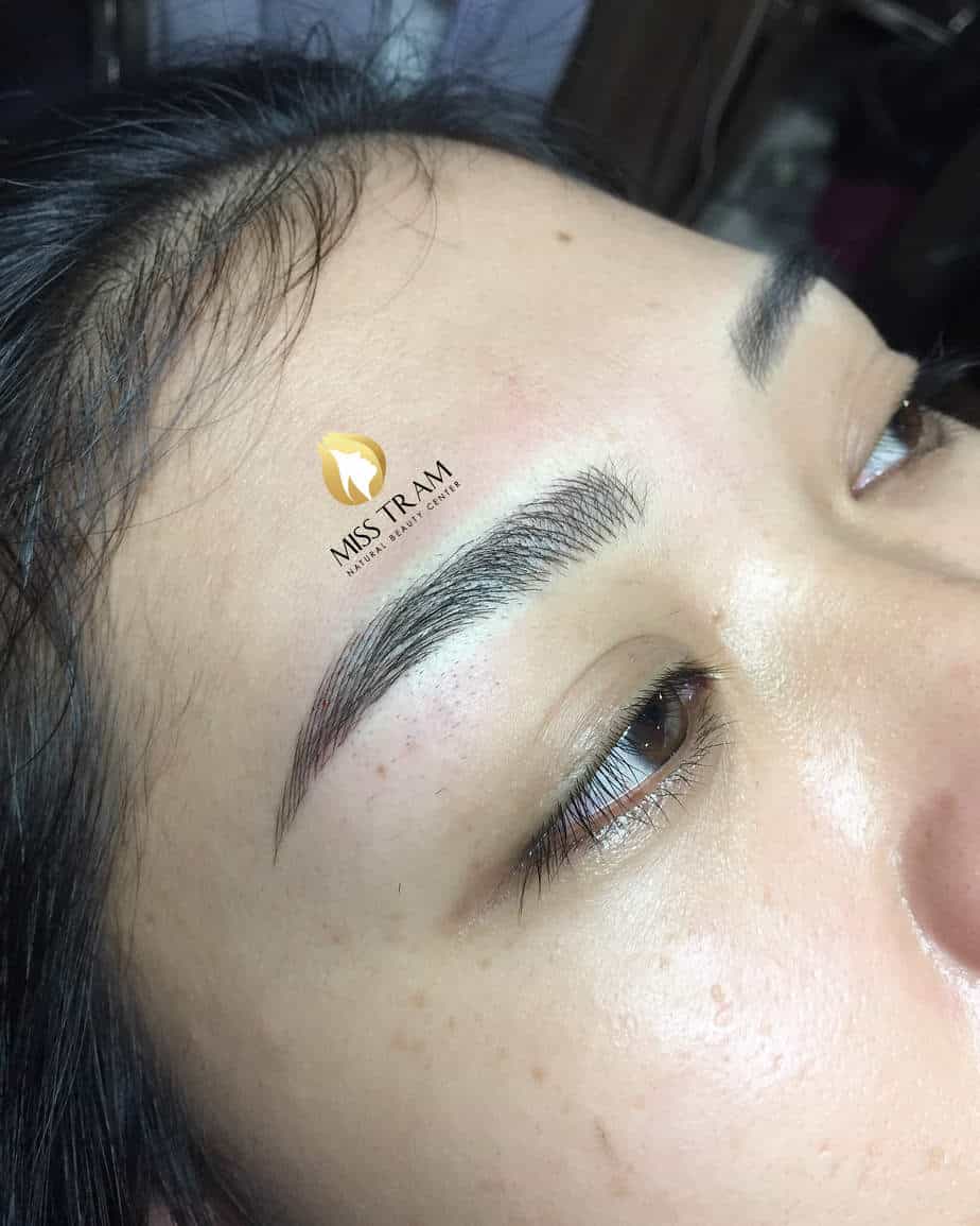 Before And After Eyebrow Sculpting Technology Creates Natural Beauty 8
