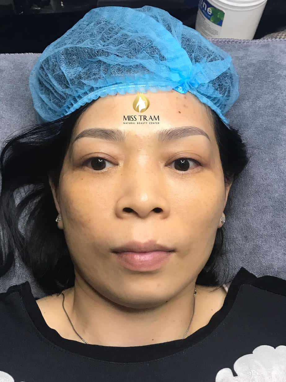 Before And After The Results Of Natural Fiber Brow Sculpting 9