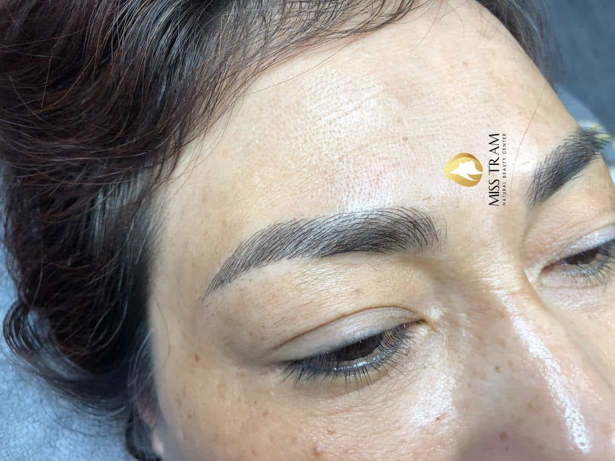 Before and After The Results of Eyebrow Sculpting Create a Natural Standard Eyebrow Shape 9
