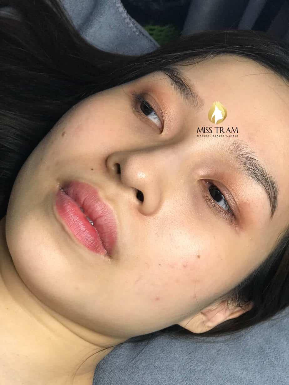 Before And After Deep Treatment And Beauty Collagen Lip Spray 10