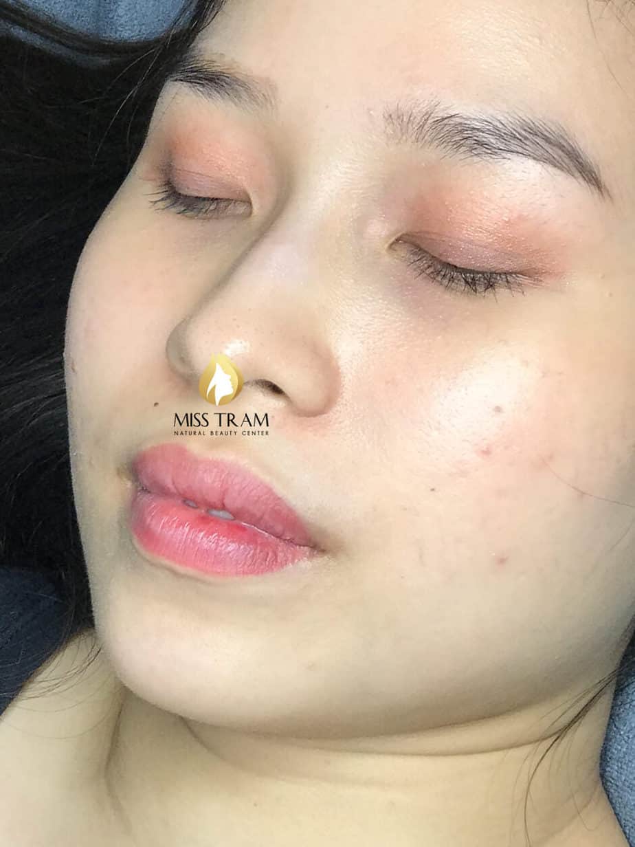 Before And After Deep Treatment And Beauty Collagen Lip Spray 11