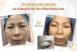 Before And After The Results Of Eyebrow Sculpting Flossing Fibers To Fix Thin Eyebrows 59