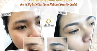 Before And After Beauty With Sculpting Technology Fixing the Eyebrow 40
