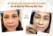 Before And After Eyebrow Sculpting with Fibers Overcoming Pale Eyebrows 42