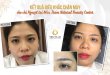 Before And After The Results Of Eyebrow Sculpting To Create A Beautiful, Harmonious Eyebrow Shape 29