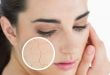 What Detox Mask Should I Use For Dry Skin? 46
