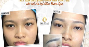 Before And After Beauty Brow Sculpting At Spa 1