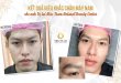 Before And After Shaping The Right Eyebrows For Men With 8 . Sculpting Technology
