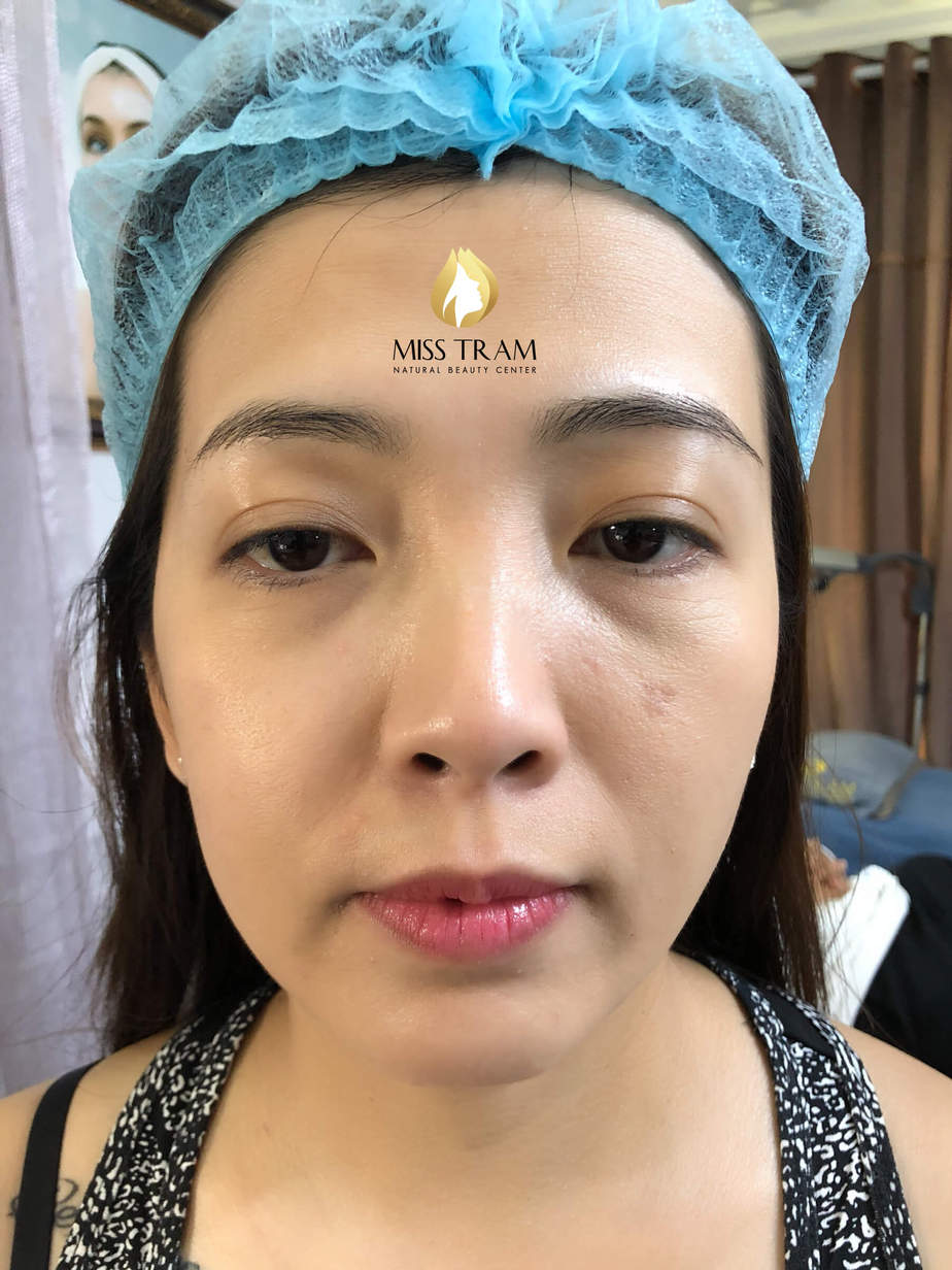 Before And After Beautifying Eyebrows By Sculpting Method 26