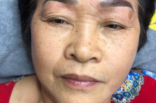 Before And After Treating Old Eyebrows - Head Sculpting Combined with Tail Powder Spraying For Women 36