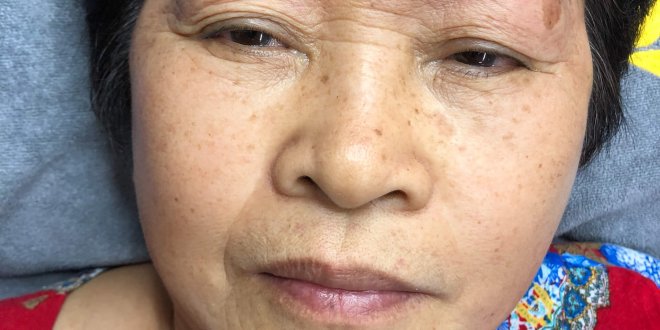Before And After Treating Old Eyebrows - Head Sculpting Combined with Tail Powder Spraying For Women 5