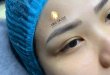 Before And After Eyebrow Sculpting Fixing Messy Ingrown Eyebrows 48
