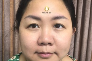 Before And After Treating Old Eyebrows - Head Sculpting And Tail Spraying 23