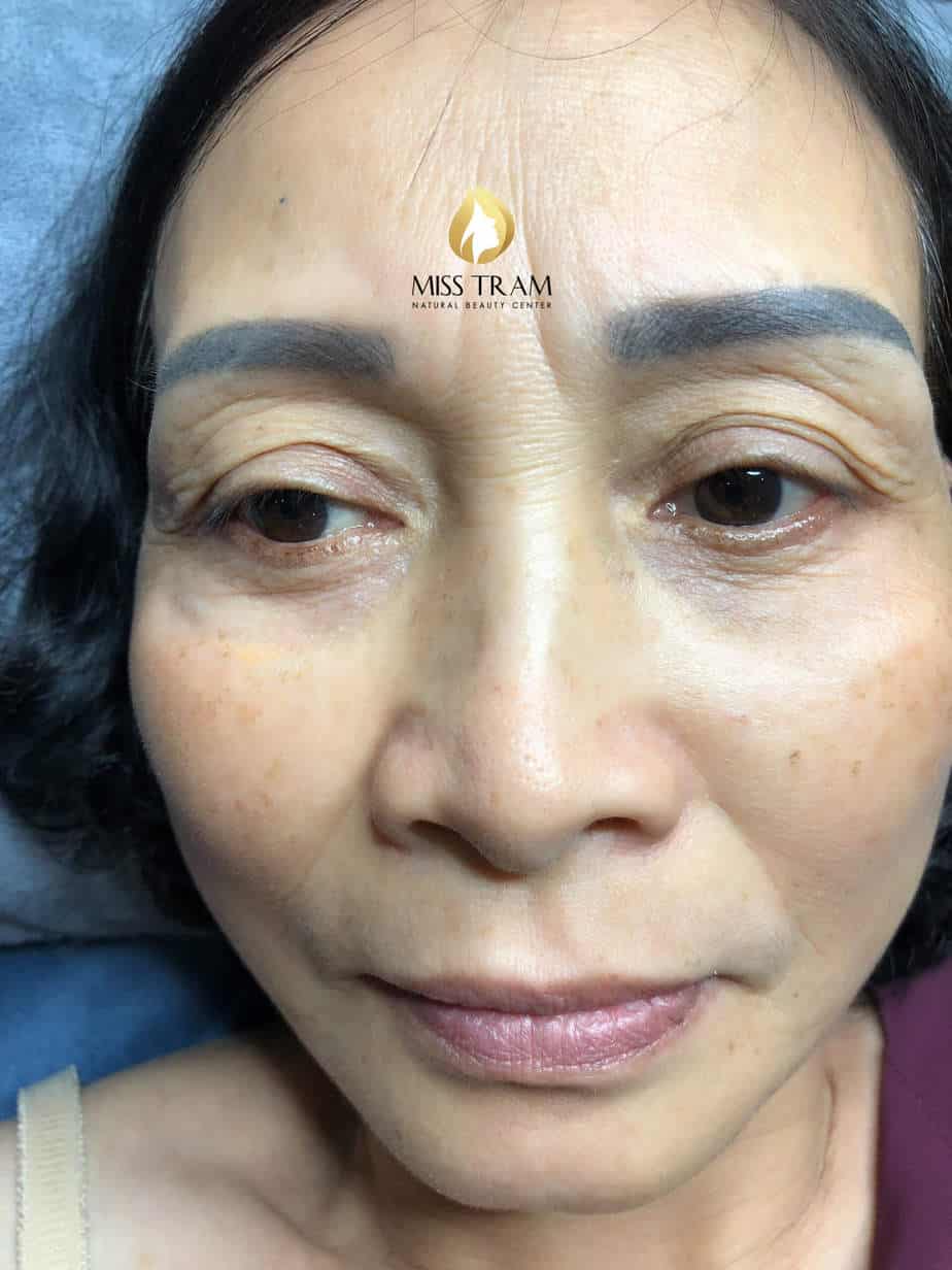 Before And After Beautifying Customers With Eyelid Spray Method 4