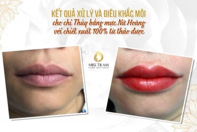 Trước Và Sau Khi Điêu Khắc Làm Đẹp Môi Bằng Mực Nữ Hoàng 5