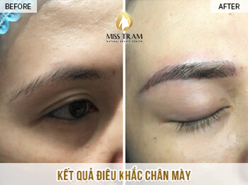 Before And After The Results Of Eyebrow Sculpting To Fix Small Eyebrow Shape 5