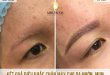 Before And After Sculpting Eyebrows For Oily Skin - Acne At Spa 7