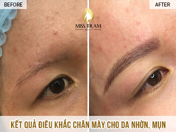 Before And After Sculpting Eyebrows For Oily Skin - Acne At Spa 5
