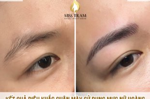 Before And After The Queen's Eyebrow Sculpting Results At Spa 19
