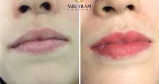 Before And After Deep Treatment, Natural Beauty Collagen Crystal Lip Spray For Women 31