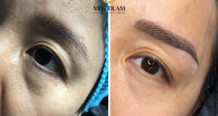 Before And After Treatment of Red Embroidered Eyebrows and Queen Eyebrow Sculpture 19