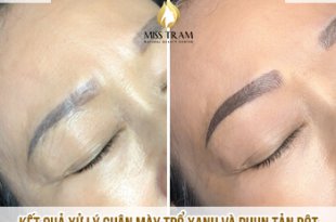 Before And After Treating Green Eyebrows And Spraying Powder 88